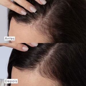 Tônico Concentrado Eudora Siàge Dermo Hair Resistência Antiqueda 100ml - Imagem 3